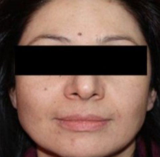 Before/After Image